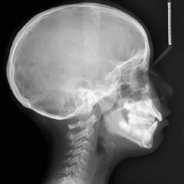 radiografia ortodoncia