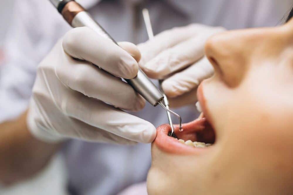 Principales diferencias entre periodontis y gingivitis