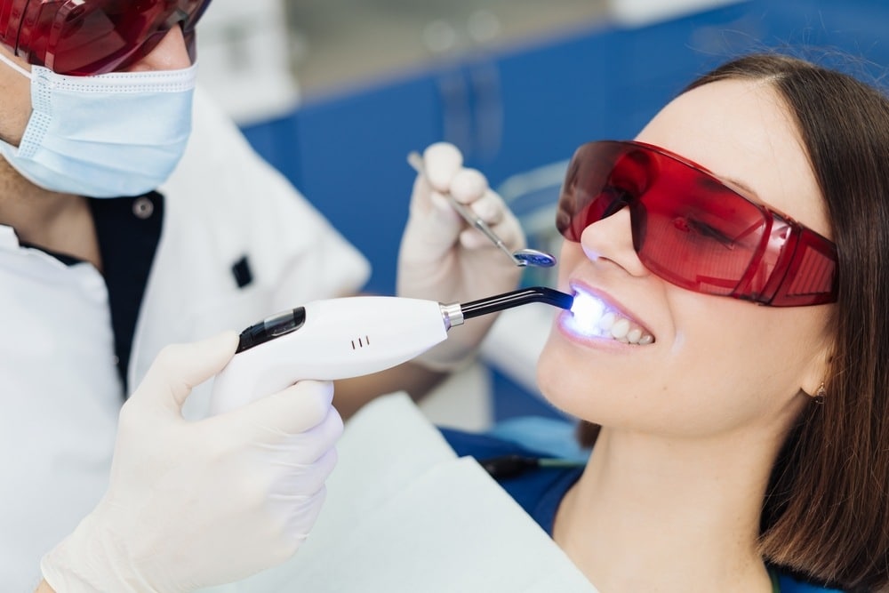 Blanqueamiento dental por profesionales en Domus Dental