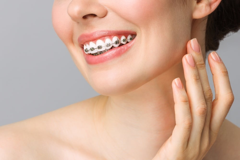 Ortodoncia invisible o brackets en Domus Dental