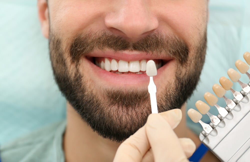 Por que elegir Domus Dental como especialistas en estetica dental