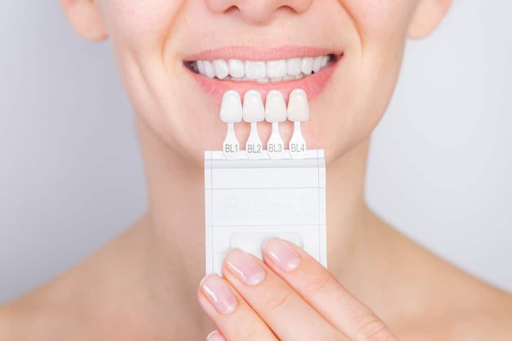 estetica dental blanqueamiento